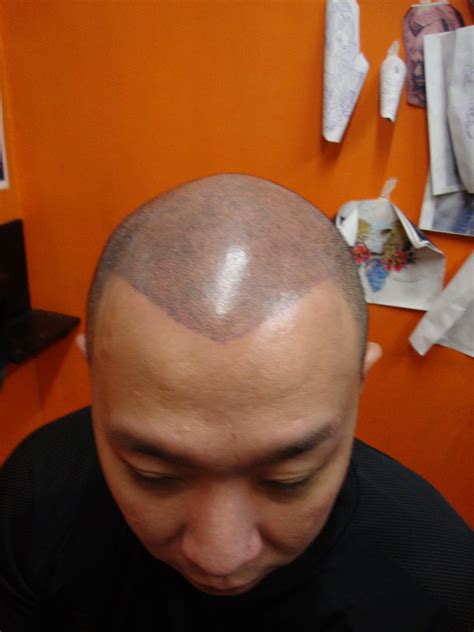scalp tattoo manila philippines|I.S. SMP .